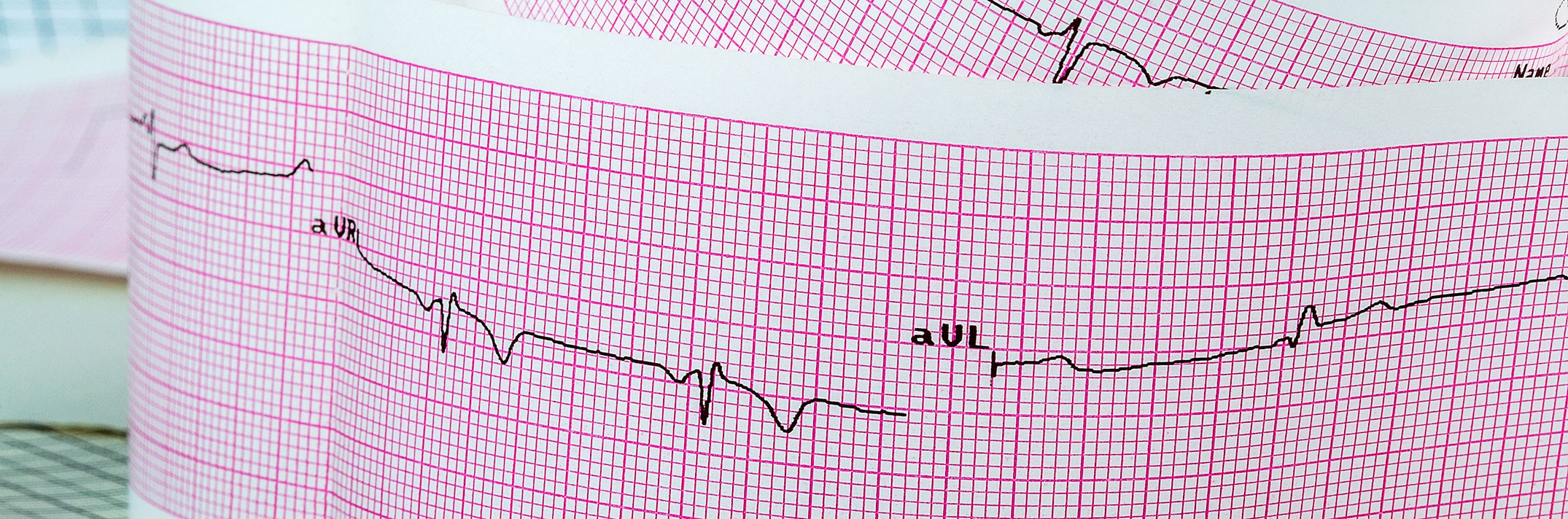 Imagerie cardiaque Radiméd canada