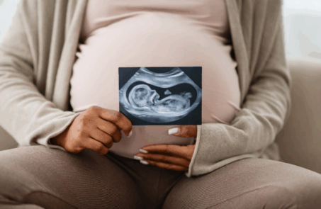 obstetrical ultrasound